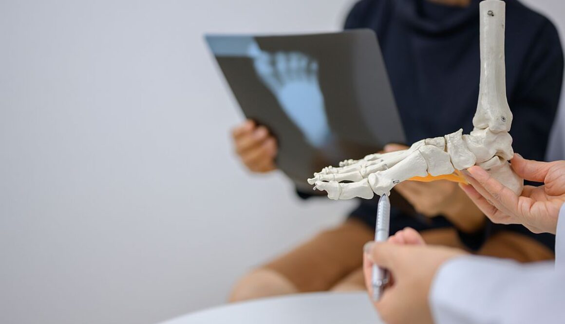 Operacja palucha koślawego